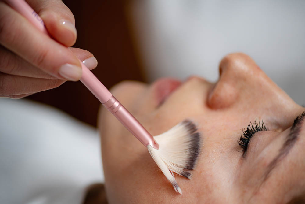 woman receiving chemical peel